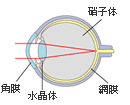屈折異常と矯正